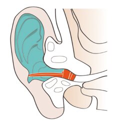 EQ SEALS-, K&auml;lteschutz EAR PLUG One Size